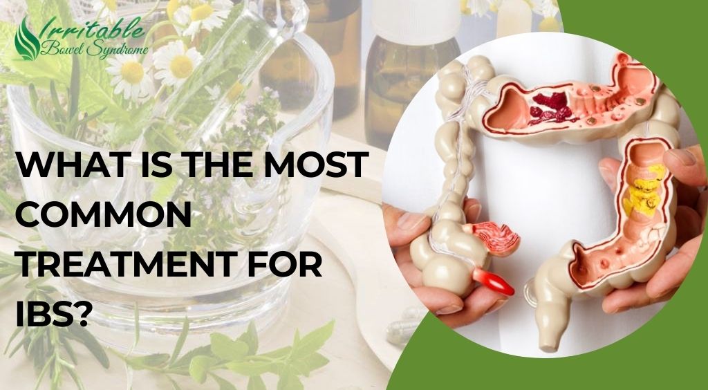 What Is the Most Common Treatment for IBS?